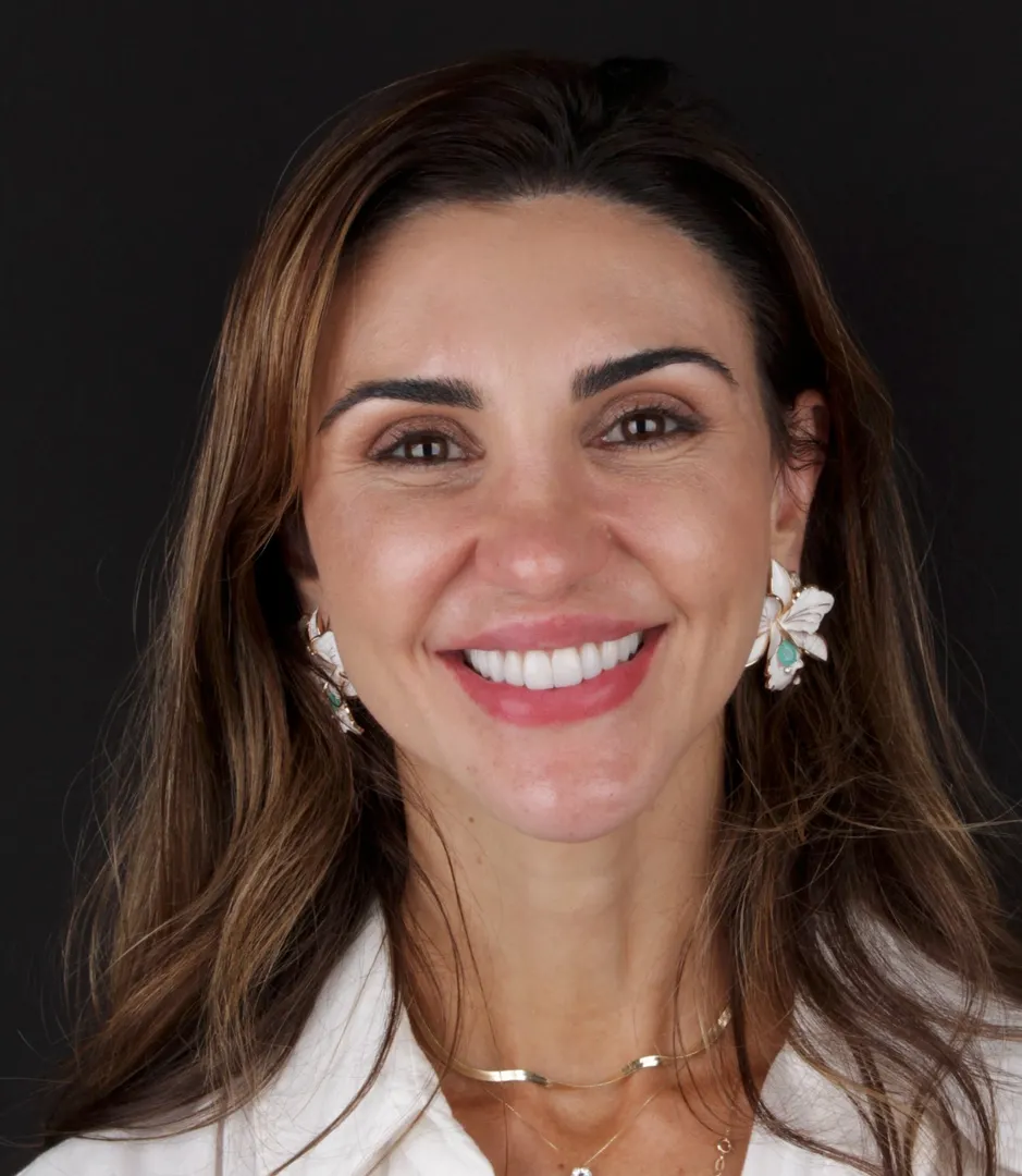 Sorriso depois das lentes de contato dental